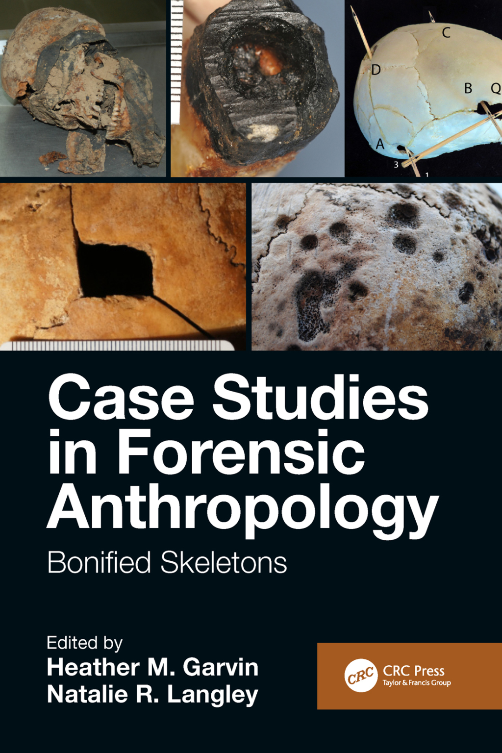 9780429792595.jpg Case Studies in Forensic Anthropology 1st edition Bonified Skeletons - Image 1